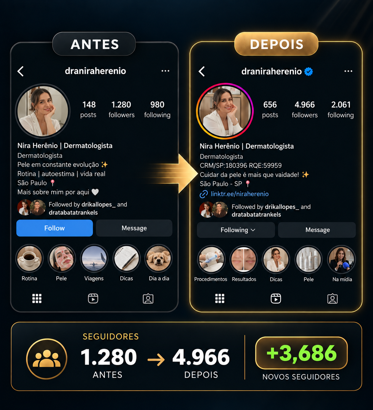 Antes e depois do perfil de @draniraherenio — dermatologista, crescimento de seguidores com a Dr. Reels